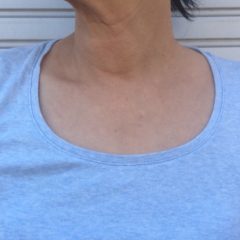 デコルテ胸元ゲッソリ対策まとめ