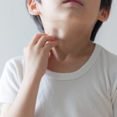 子どものアレルギー原因：食べ物の影響とは？